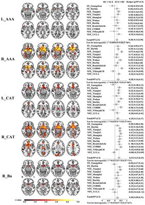 Selective disrupted gray matter volume covariance of amygdala subregions in schizophrenia